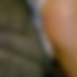 DP